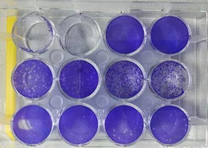 राष्ट्रीय अनुसंधान प्रयोगशालाओं और विश्वविद्यालयों में कोविड जांच केन्द्रों की संख्या में बढ़ोतरी